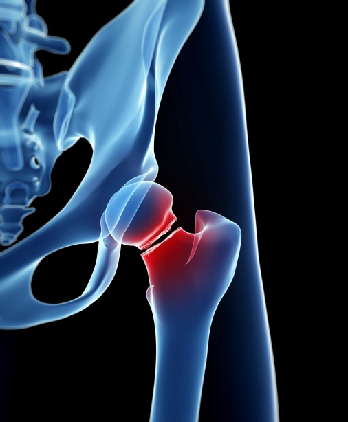 Cyclists are at Higher than Normal Risk!